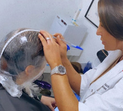 Process of Cr Labs treatment on scalp