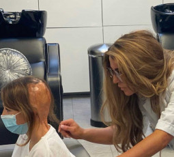 Doctor treating scalp of young girl